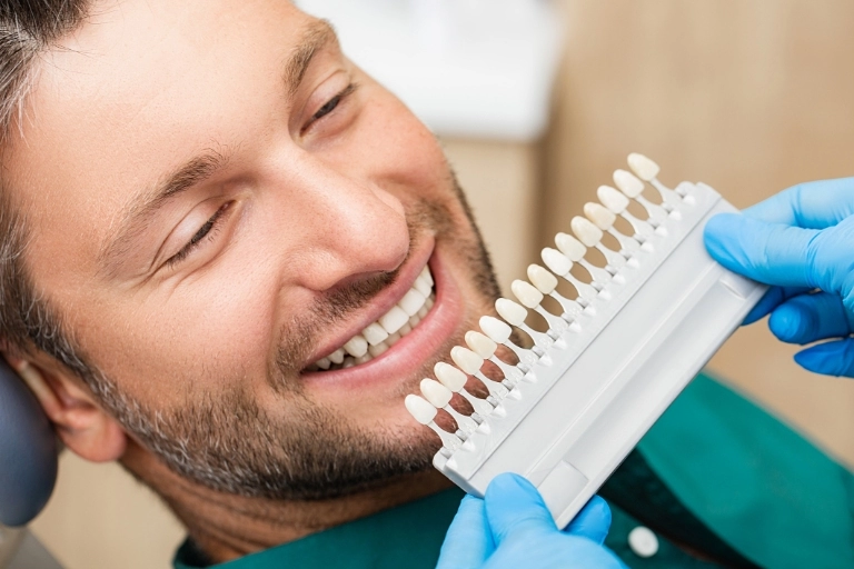 dobieranie odcieniu zębów